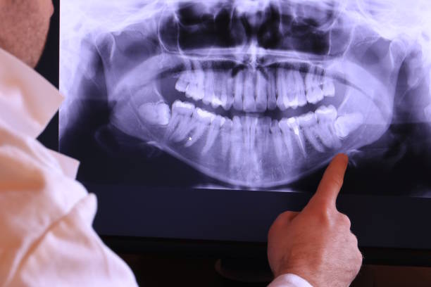 Best Mobile Emergency Dentist in Pawnee, IL